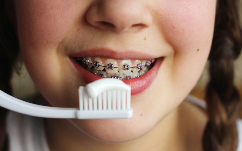 Tooth Enamel: What is It?